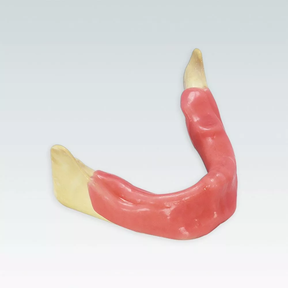 A-J KW Стоматологическая модель беззубой нижней челюсти для имплантации  со слизистой