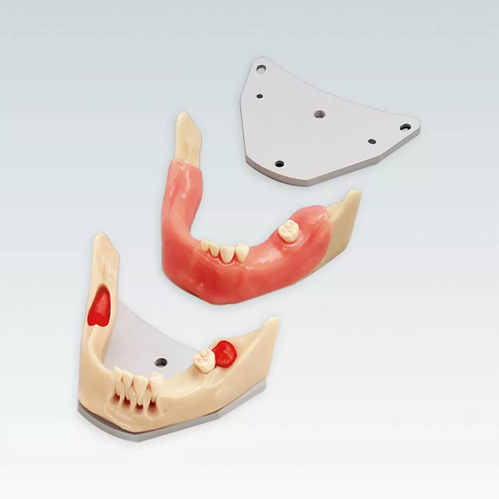 A-J OP UK Стоматологическая модель нижней челюсти для хирургии с ретинированными зубами мудрости