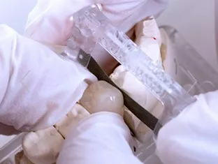 IPR Single-Sided Opener Прозрачная  - 0,10 мм