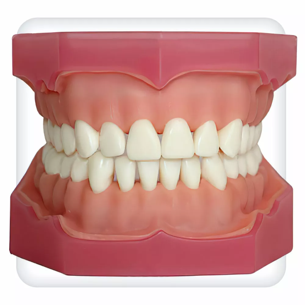 Модель верхней и нижней челюстей с 32 интактными зубами для анестезии