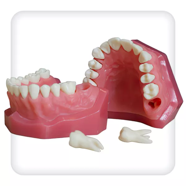 Модель верхней и нижней челюстей с 28 интактными зубами для удаления