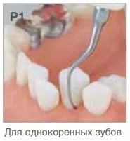Насадка P1 пародонтологическая к ультразвуковым скалерам Varios