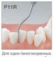 Насадка P11R пародонтологическая к ультразвуковым скалерам Varios