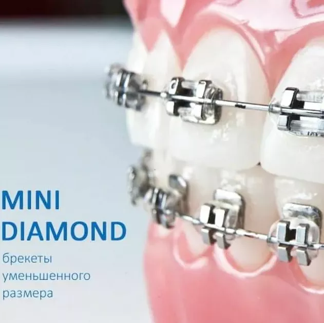 Брекет Mini-Diamond(Roth 018 1 прем н.ч. универсальный) 350-0625