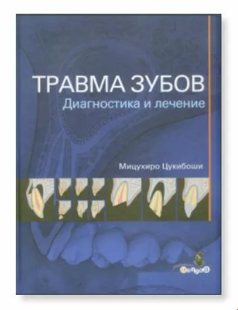 Книга "Травма зубов. Диагностика и лечение" М. Цукибоши