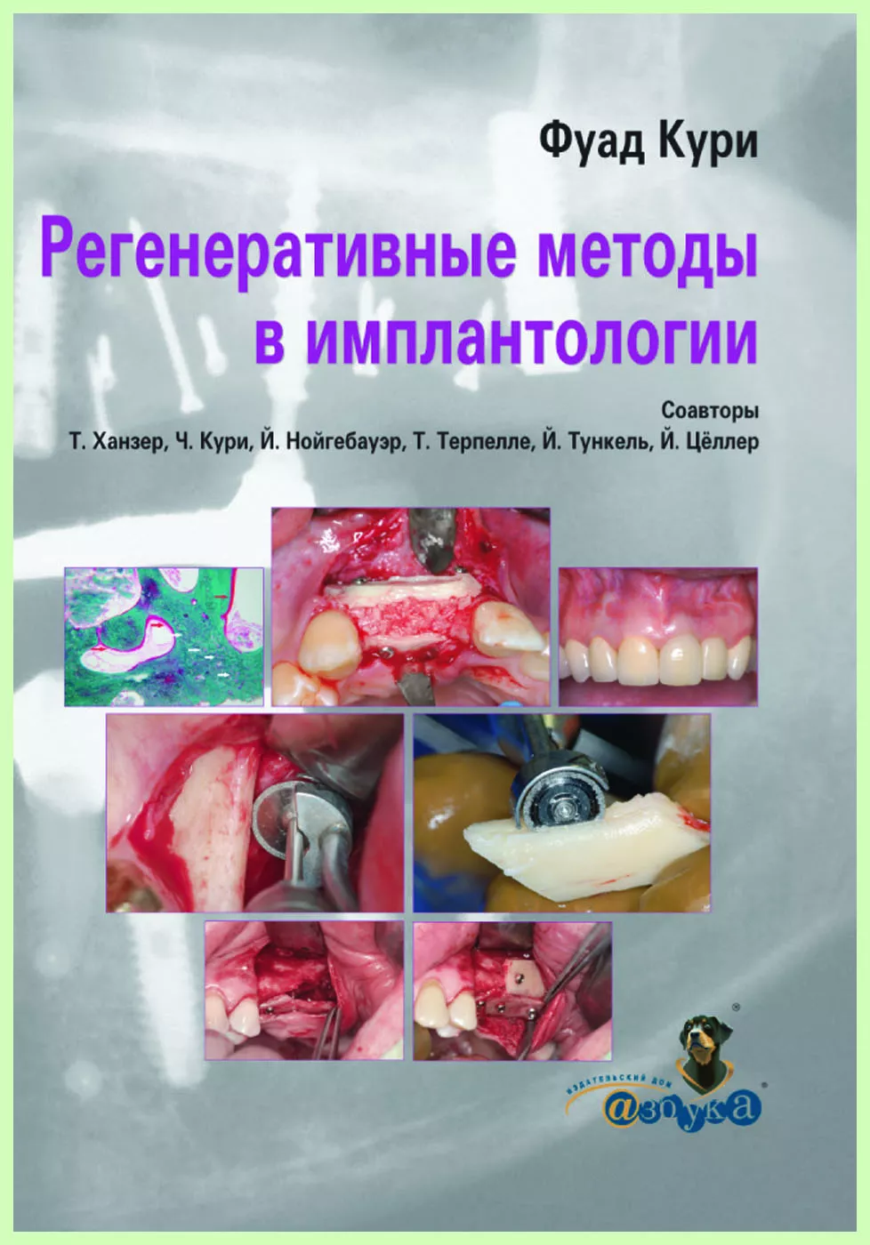 Регенеративные методы в имплантологии / Ф. Кури | bh.market - Медицинский  маркетплейс