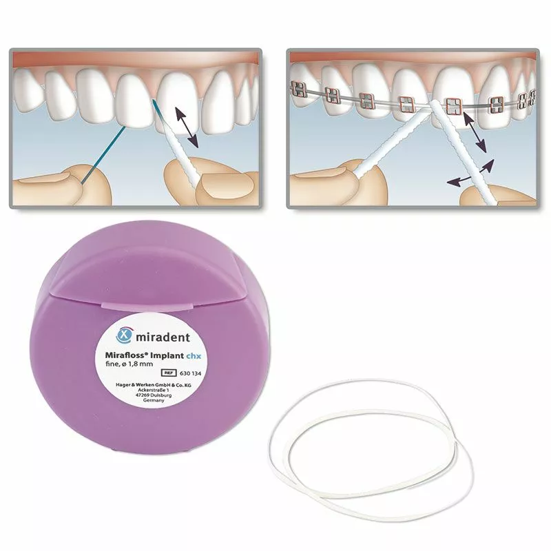 Мирадент mirafloss-implant-chx fine-superflos-srednii