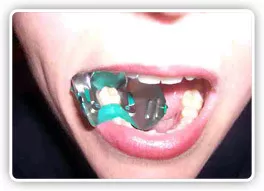 Зажимное устройство для изоляции зубов (Super-Clamp)