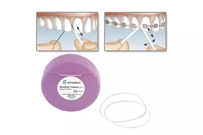 Зубная нить Mirafloss Implant Chx fine (розовый)