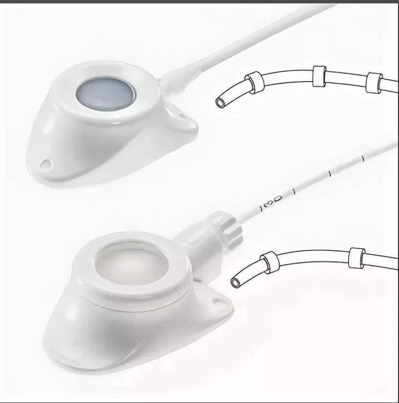 PorTal Access Secures FDA Clearance for FLEXI-PORT Vascular System